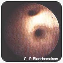 Figure 9. Bifurcation of the saphenous trunk.