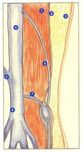 Figure 94. Veine perforante sus-poplitée.