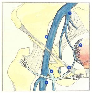 Figure 27. Anatomical relations between the pelvic venous system and the long saphenous vein.