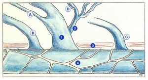 Figure 30: Types of anastomosis of an accessory saphenous vein. 