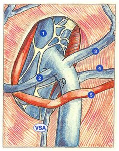 Figure 31: Accessory saphenous vein (ASV). Anastomosis in the arch of the long saphenous vein.