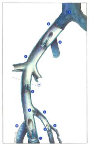 Figure 40: Iliofemoral and saphenous valves