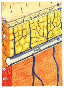 Figure 44: Trois plans veineux superposés.