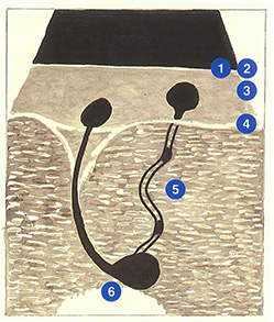 Figure 46: Veines perforantes à l'échographie (coupe transversale de jambe).