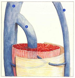 Figure 47. Multibranched perforating vein: connection with two deep trunks.