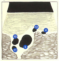 Figure 60C: Région inguinale (image échographique)