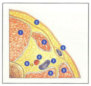 Figure 61A: Veines perforantes du canal de Hunter (perforante de Dodd).