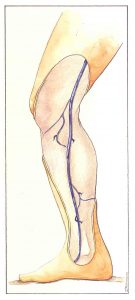 Figure 62: Perforating veins anastomosing with the long saphenous vein in the leg or on a localized diversion.
