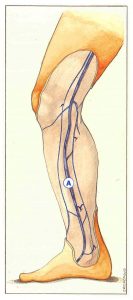 Figure 63: Perforating veins anastomosing with an anterior or posterior accessory saphenous vein in the leg.