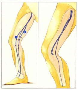 Figure 66: Long and accessory saphenous veins.