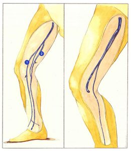 Figure 66: Long and accessory saphenous veins.