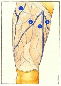 Figure 67. Veines collatérales proximales du tronc saphène interne.